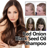 Eelhoe Red Onion And Black Seed Oil Hair Care Essential Oil, Nourishing And Nourishing Hair, Smoothing And Repairing Dry Hair