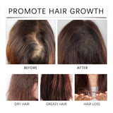 Palm Oil Hair Care Essence, Scalp Massage Treatment Repair Dry Hair, Soft And Solid Hair