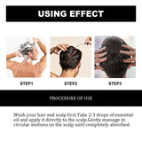 East Moon Hair Growth Oil, Protect Hair Follicle Moisture Nutrition Hair Root Strength Thick Hair Essence